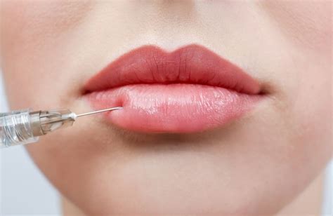 Luxury Facilities and Lip Filler Pricing: Is There a Link?
