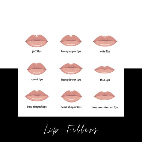 Negotiating Lip Filler Prices: Can You Haggle for a Better Deal?