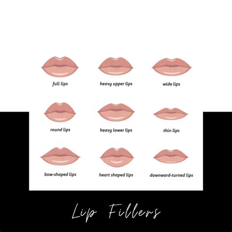 Virtual Lip Filler Consultations: Are They Worth the Fee?