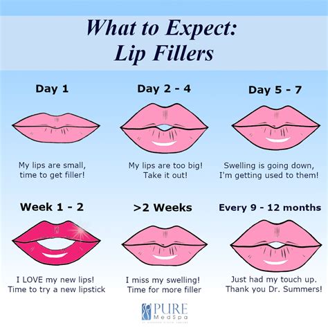 Lip Filler Showdown: A Comprehensive Price Comparison