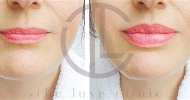 Beauty and Savings: Strategies to Trim Lip Filler Costs