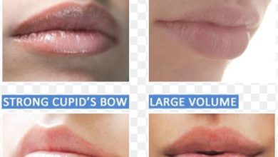 Lip Filler Competition: Which Option Offers the Best Value?