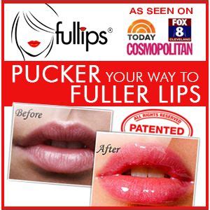 Lip Filler Discounts and Deals: Where to Find Them